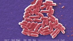 The mcr-1 plasmid-borne colistin resistance gene has been found primarily in Escherichia coli, pictured.