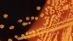 Colonies of E. coli bacteria are seen in a microscopic image courtesy of the CDC