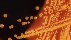 Colonies of E. coli bacteria grown on a Hektoen enteric (HE) agar plate are seen in a microscopic image courtesy of the U.S. Centers for Disease Control
