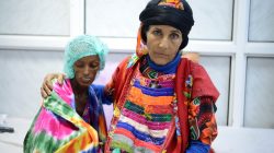 Malnourished woman with her relative at Yemeni hospital