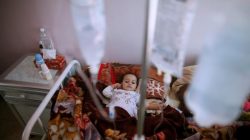 A girl lies on a bed at a cholera treatment center in Sanaa, Yemen,