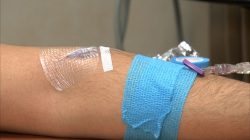 A participant prepares to receive an antibody infusion of a drug that is part of a clinical trial for a functional HIV cure at the National Institutes of Health in Bethesda, Maryland, U.S. November 22, 2016 in this still image from video.