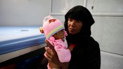 a Yemeni woman holds her malnourished son