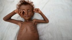 A malnourished boy lies on a bed outside his family's hut in al-Tuhaita district of the Red Sea province of Hodaida, Yemen September 26, 2016. REUTERS/Abduljabbar Zeyad
