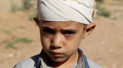 FILE PHOTO: Mukhtar Hadi, who survived a Saudi-led air strike that killed dozens including children, stands outside his house in Saada, Yemen September 4, 2018. Picture taken September 4, 2018. REUTERS/Naif Rahma/File Photo