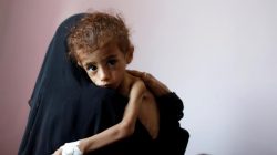 A woman holds a malnourished boy in a malnutrition treatment centre at the al-Sabeen hospital in Sanaa, Yemen October 6, 2018. REUTERS/Khaled Abdullah TPX IMAGES OF THE DAY - RC17865BEC40
